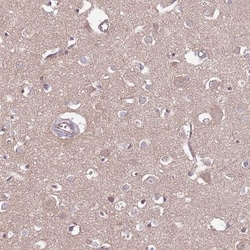 DPP10 Antibody, Novus Biologicals 25 &mu;L, Unlabeled:Antibodies, Polyclonal